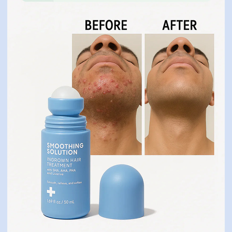 Ingrown Hair + Bump Control Serum – Visible results within a week.