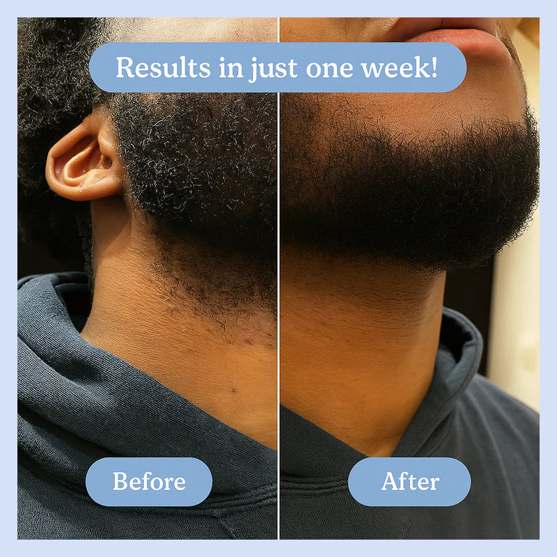 Ingrown Hair + Bump Control Serum – Visible results within a week.