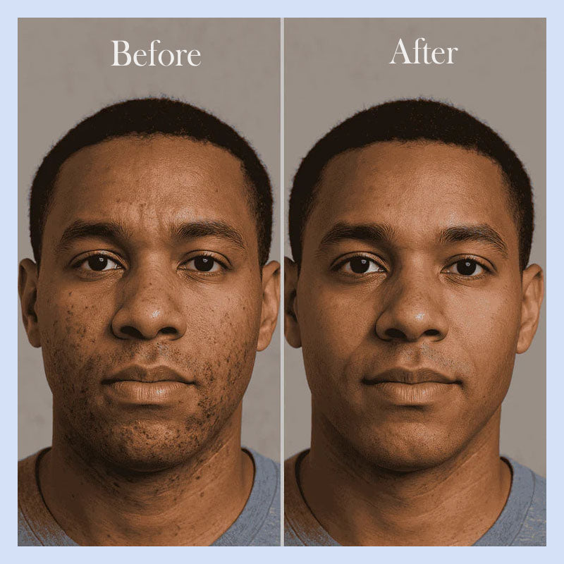 Ingrown Hair + Bump Control Serum – Visible results within a week.