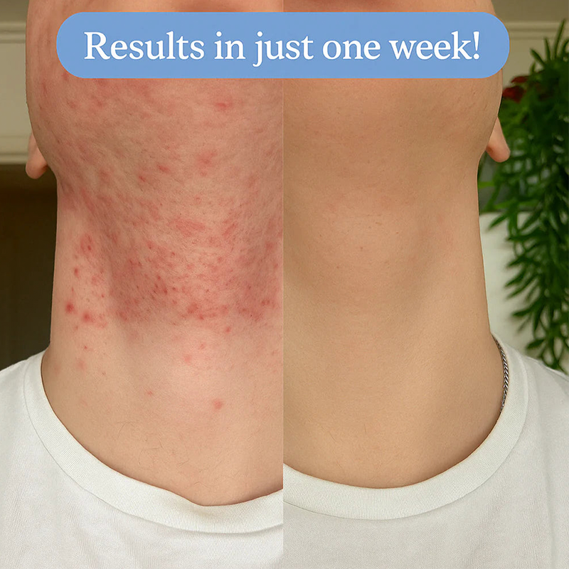Ingrown Hair + Bump Control Serum – Visible results within a week.